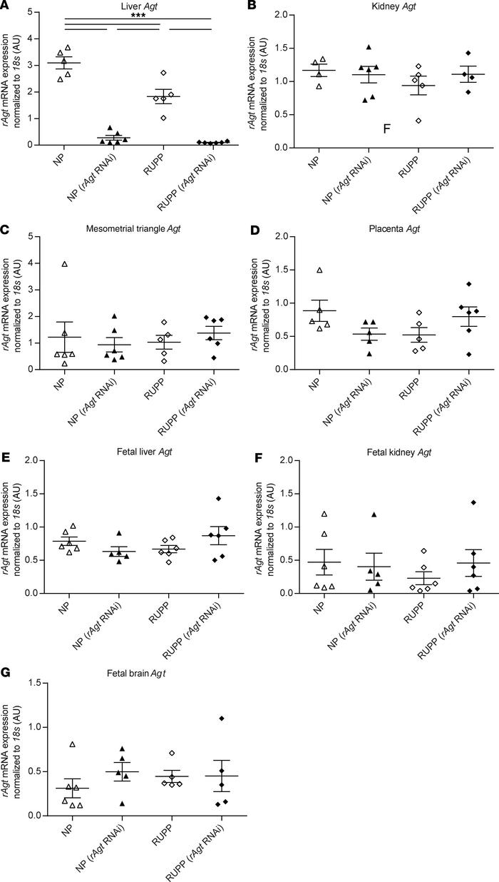 siRNA does not suppress extrahepatic or fetal Agt in normal pregnant or ...