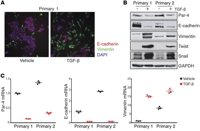 EMT is sufficient to suppress Par-4 expression.
(A) Immunofluorescence s...