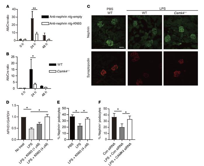 Inhibition or genetic deletion of CaMK4 protects mice from LPS-induced p...
