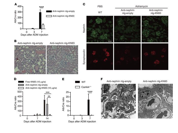 Podocyte-targeted delivery of KN93 prevents and reverses adriamycin-indu...