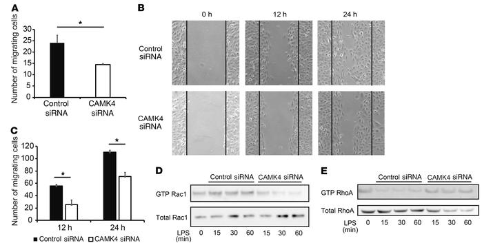 CaMK4 regulates podocyte migration.
(A) Result of Transwell migration ex...
