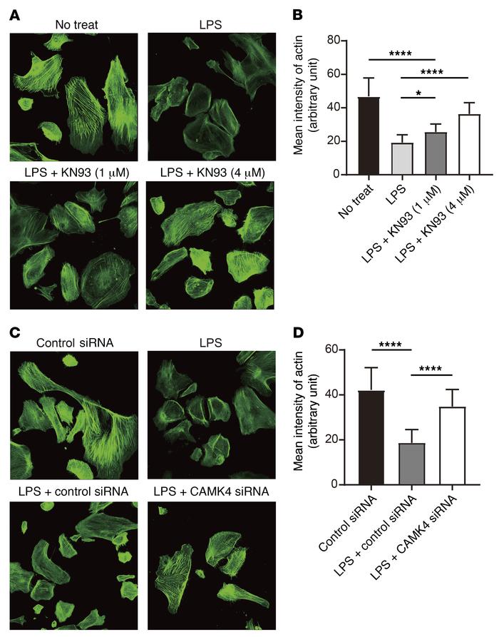 Inhibition or silencing of CaMK4 preserves actin structure of podocytes....