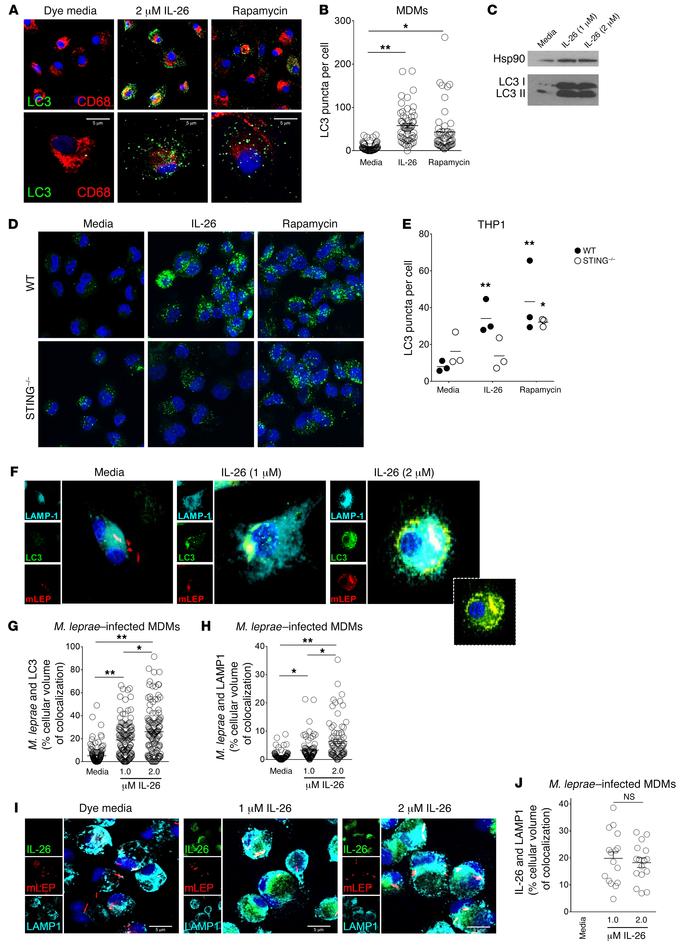 IL-26 induces autophagy and enhances bacterial trafficking to the lysoso...