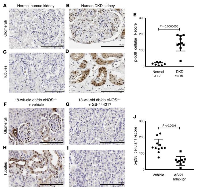 The ASK1 pathway is activated similarly in DKD patients and db/db eNOS–/...