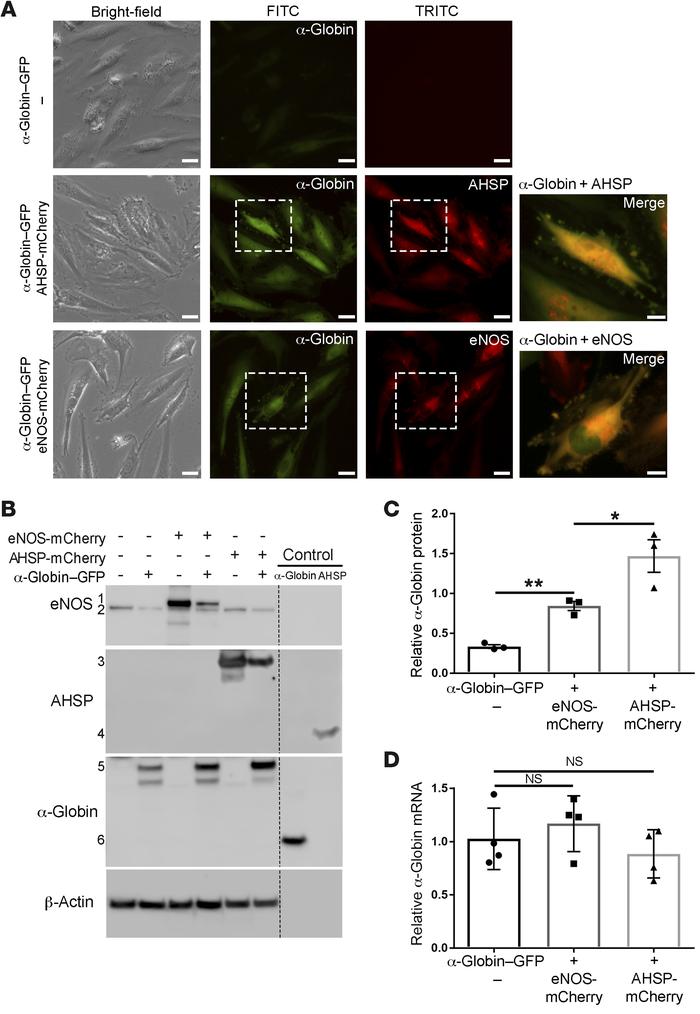 AHSP or eNOS stabilizes α-globin in cells.
(A) Human coronary ECs were t...