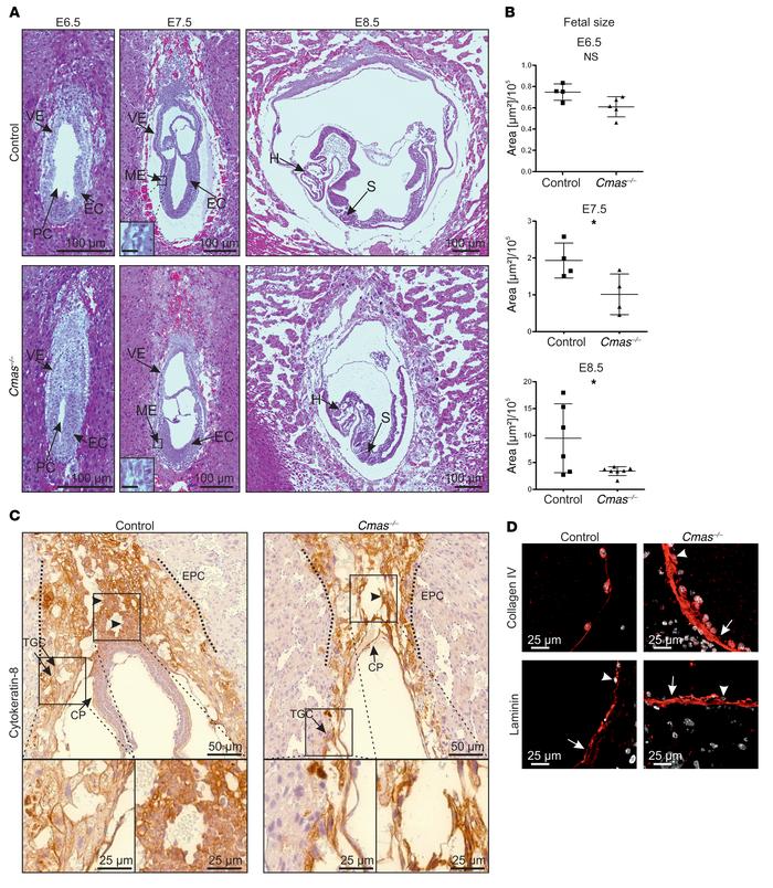 
Cmas–/– mice exhibit IUGR and extraembryonic developmental deficits.
(A...
